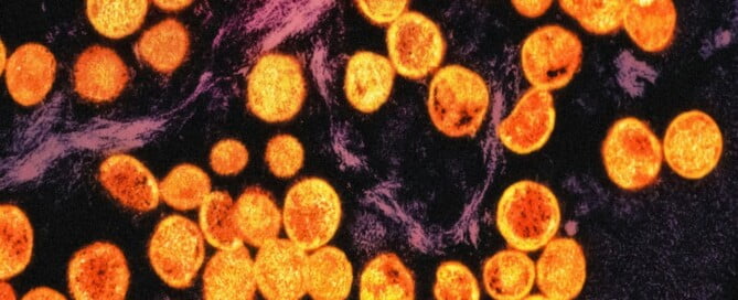 a close-up of orange and purple cells